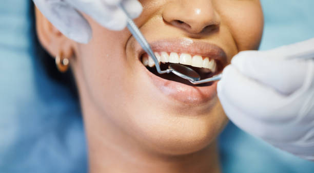 Best Urgent Care for Lost Fillings or Crowns in Wamac, IL