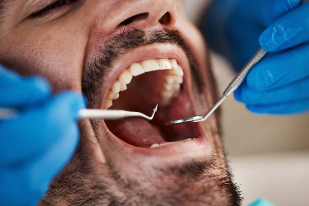 Best Emergency Treatment for Dental Infections or Abscesses in Wamac, IL